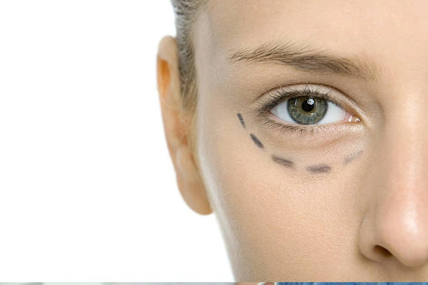 Eye Filler
