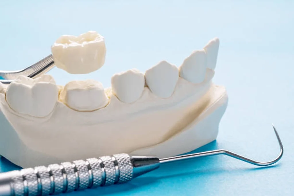 same color dental crown