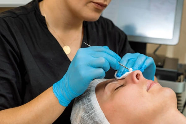 nasal filler