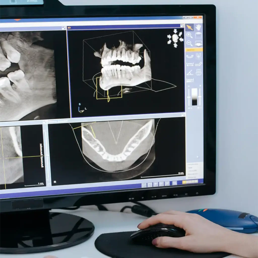 dental Orthodontist x-ray