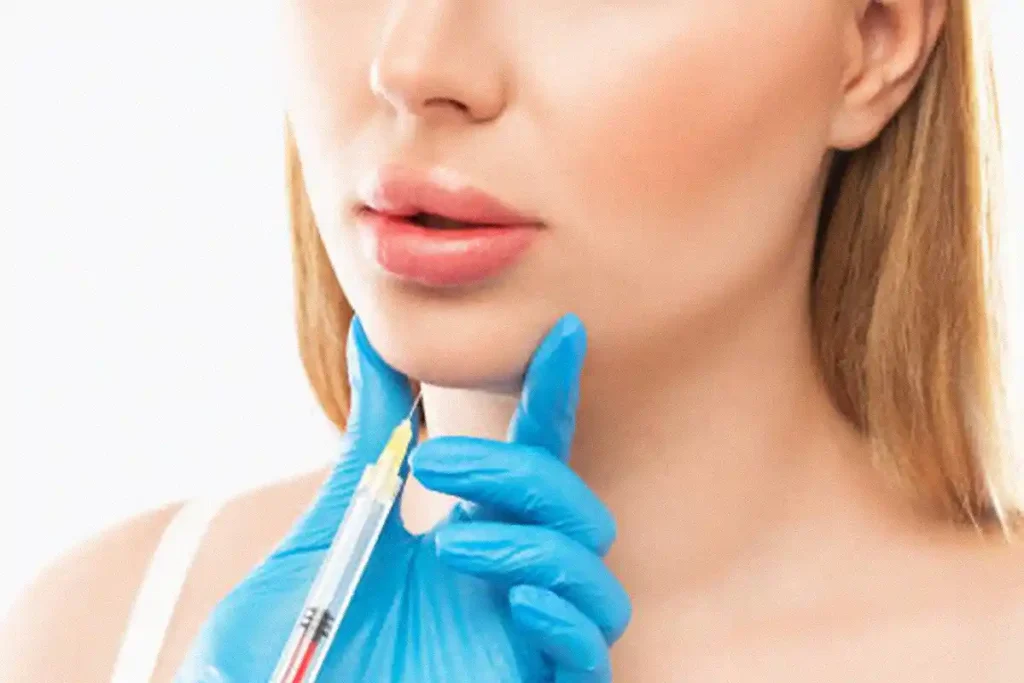 chin filler treatment