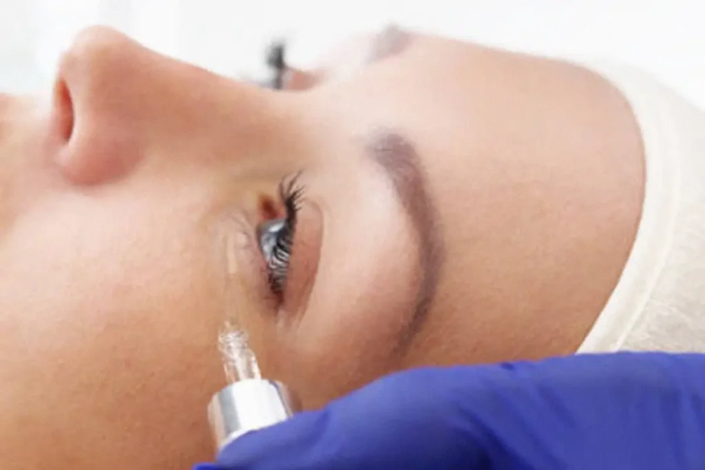 getting trear filler treatment