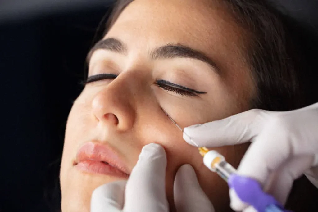 getting under eye filler treatment