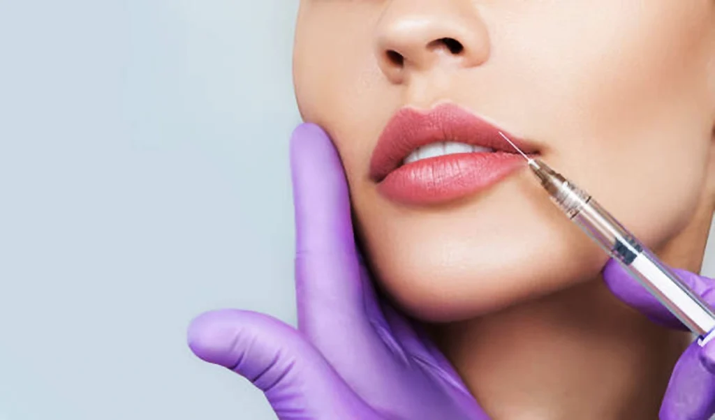 girl getting lip filler treatment at queen's gate dental