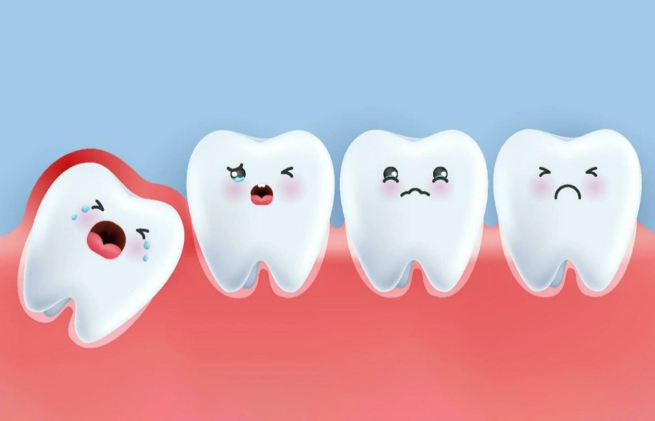 wisdom teeth